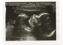 Baby Deaton 