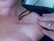 scar.png
