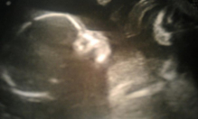 Baby M 20 weeks