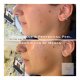Non Surgical Medical Aesthetics