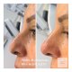 Non Surgical Medical Aesthetics