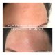 Non Surgical Medical Aesthetics