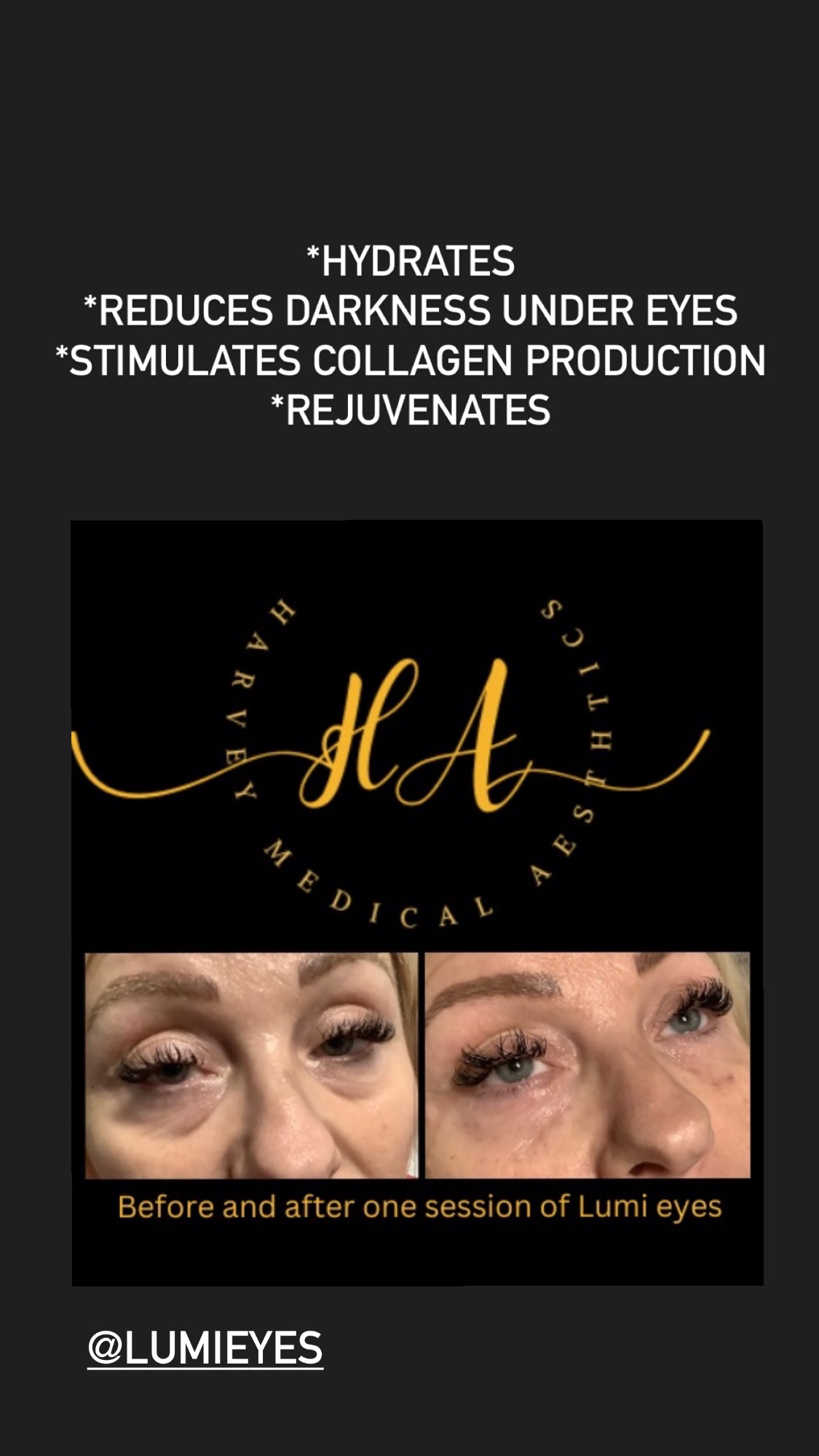 Harvey Medical Aesthetics-Image-16