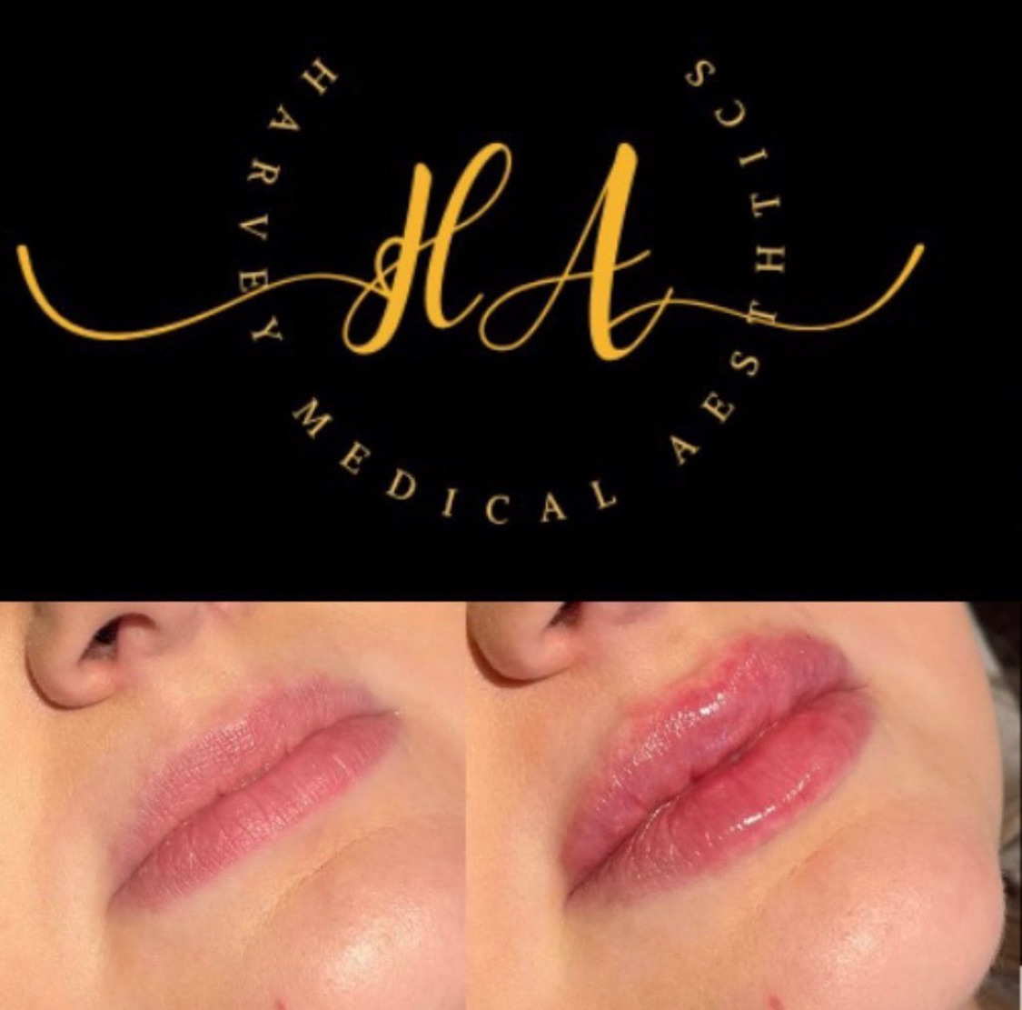 Harvey Medical Aesthetics-Image-26