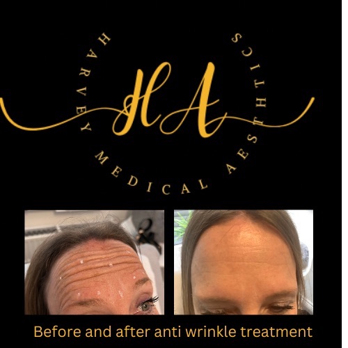 Harvey Medical Aesthetics-Image-43