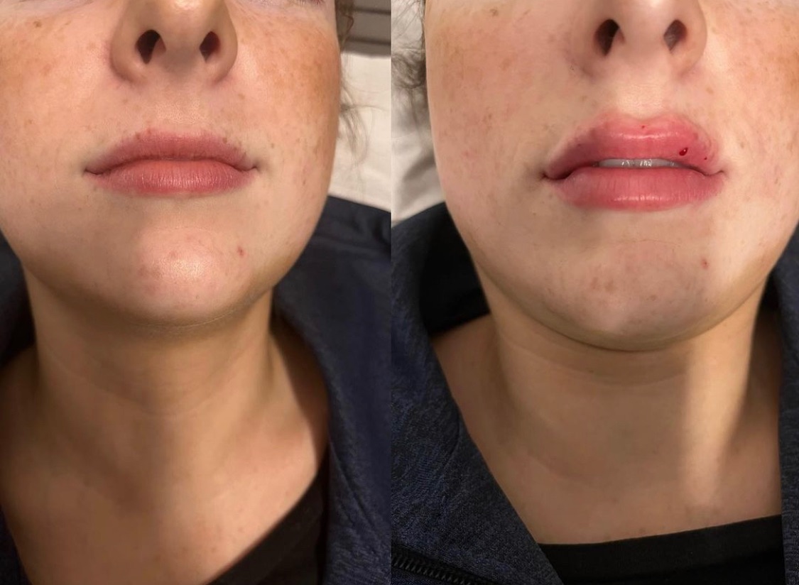 Harvey Medical Aesthetics-Image-32