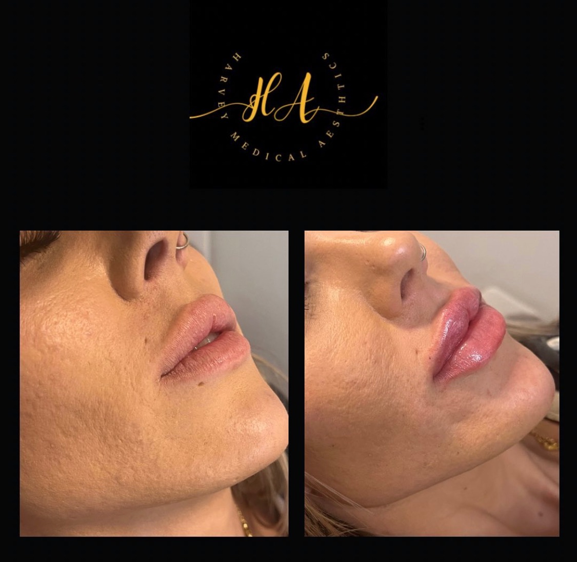 Harvey Medical Aesthetics-Image-25