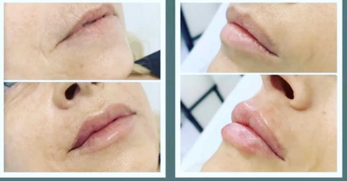 Harvey Medical Aesthetics-Image-34