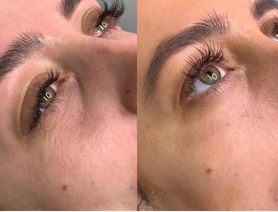 Harvey Medical Aesthetics-Image-27