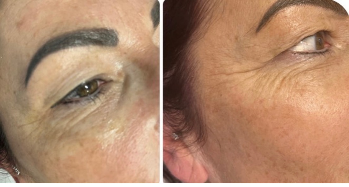 Harvey Medical Aesthetics-Image-28