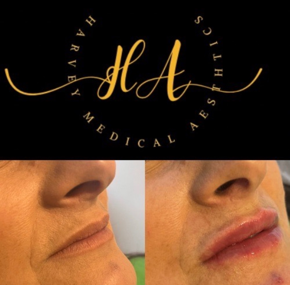 Harvey Medical Aesthetics-Image-39