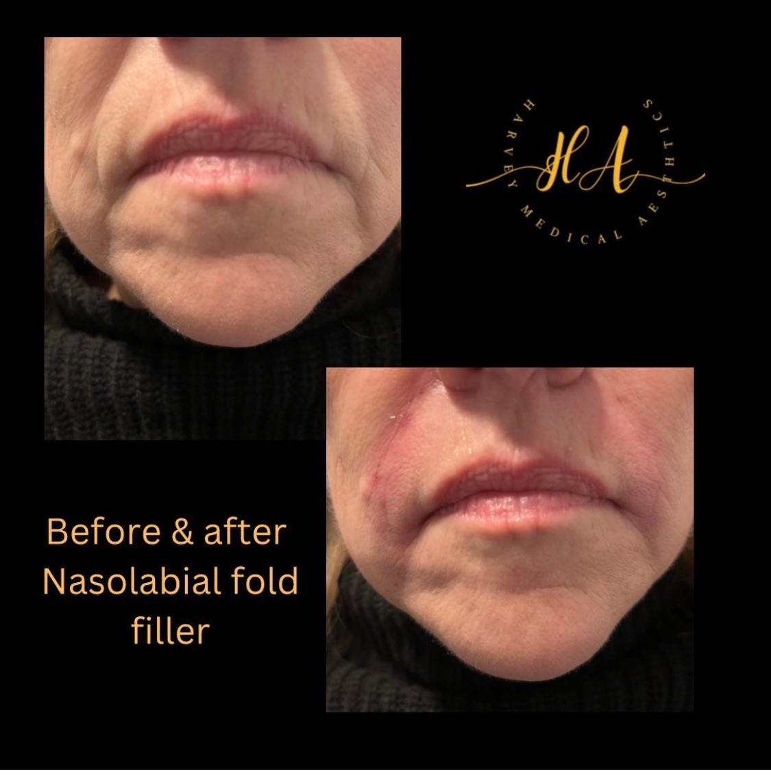 Harvey Medical Aesthetics-Image-24